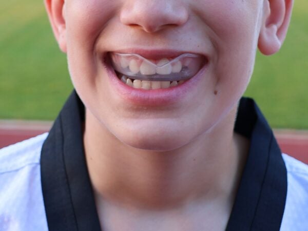 zaštitna guma za zube